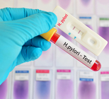 הליקובקטר פילורי: אבחון וטיפול-תמונה